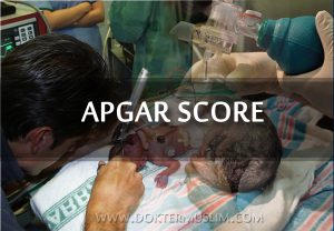 apgar score