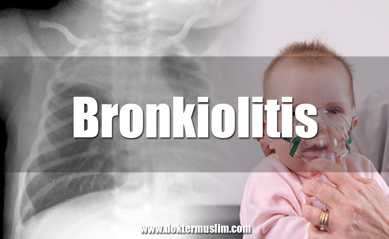 Bronkiolitis : Gejala, Penyebab dan Tatalaksana