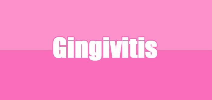 Gingivitis atau Radang Gusi Bengkak : Gejala hingga Pengobatan