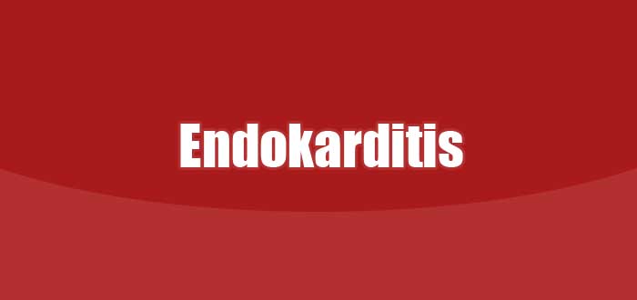 Endokarditis : Gejala, Pemeriksaan hingga Tatalaksana