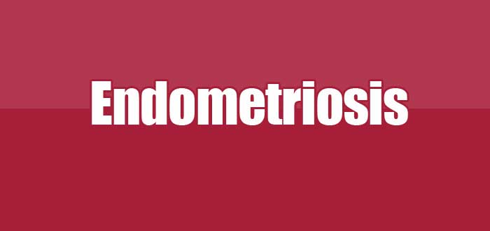 Endometriosis : Gejala hingga Pengobatan [Lengkap]
