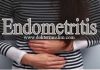 endometritis
