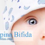 jenis spina bifida