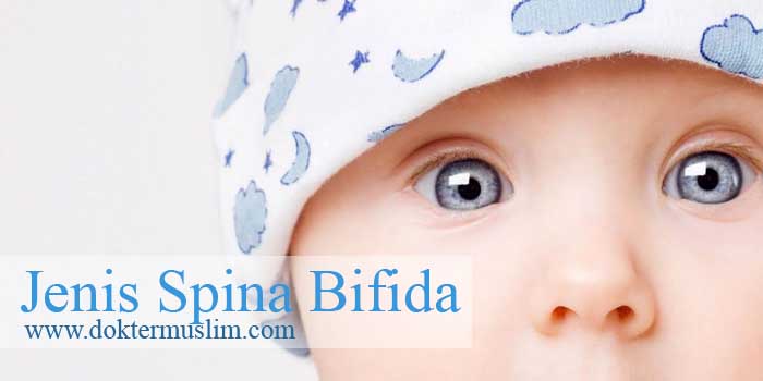 jenis spina bifida