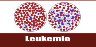 perbedaan leukemia akut dan kronis