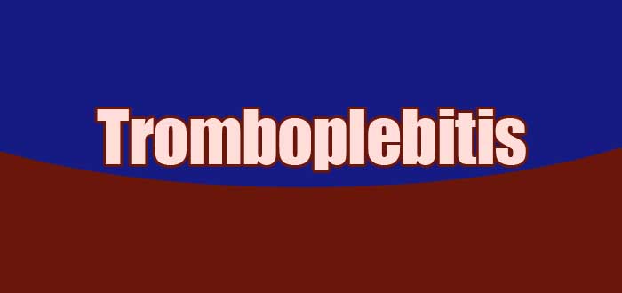 tromboplebitis