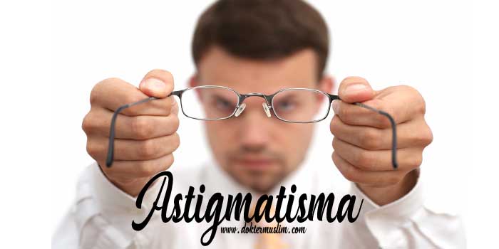 Astigmatisma (Mata Silinder) : Gejala hingga Tatalaksana