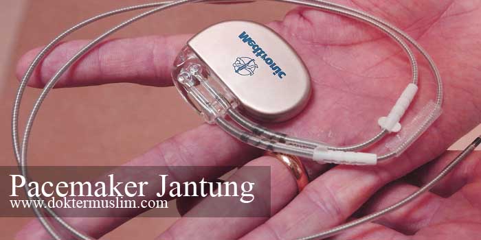 pacemaker jantung