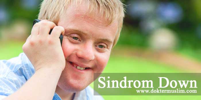 Sindrom Down : Penyebab Genetik, Gejala dan Tatalaksana