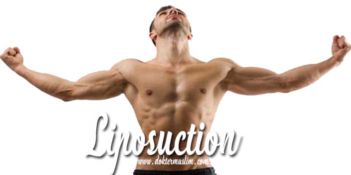 Sedot Lemak (Liposuction) : Jenis, Manfaat hingga Efek Samping