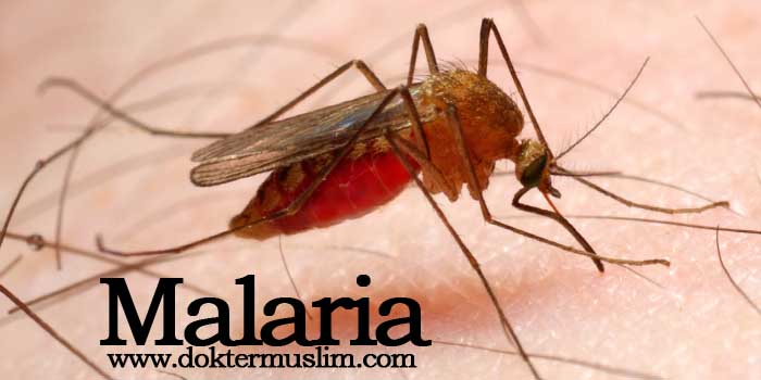 Malaria (Overview) : Etiologi, Gejala dan Tatalaksana