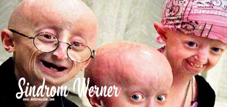 Sindrom Werner : Penuaan Dini Mutasi gen WRN