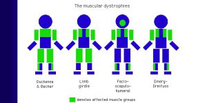 muscular dysthrophy