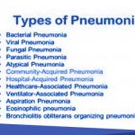 jenis pneumonia